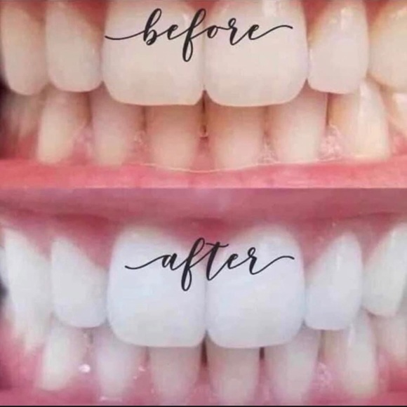 Whitening Toothpaste 🦷 - Picture 4 of 8